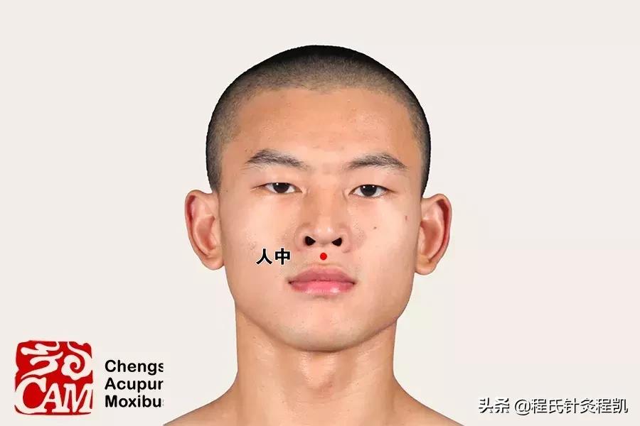 中暑掐人中有什么作用,中医中暑急救