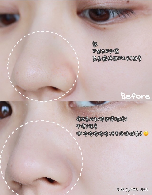 清洁面膜敷补水面膜,c咖清洁面膜