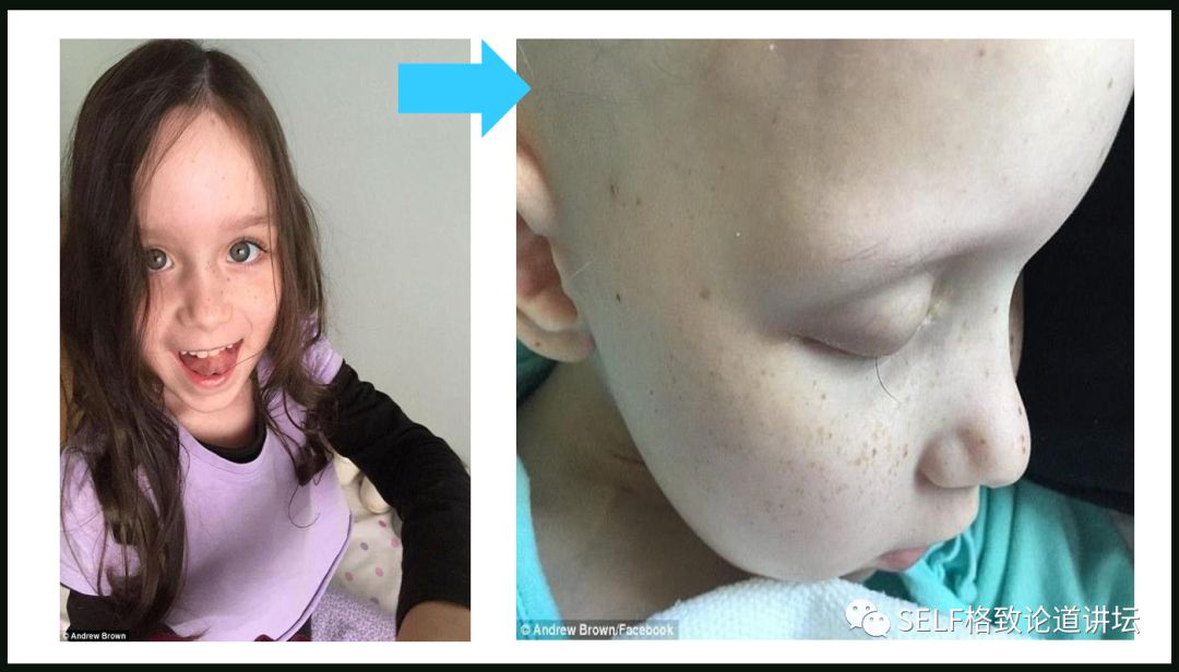 这个装置成功辅助我国两弹爆炸，现在它能治疗肿瘤