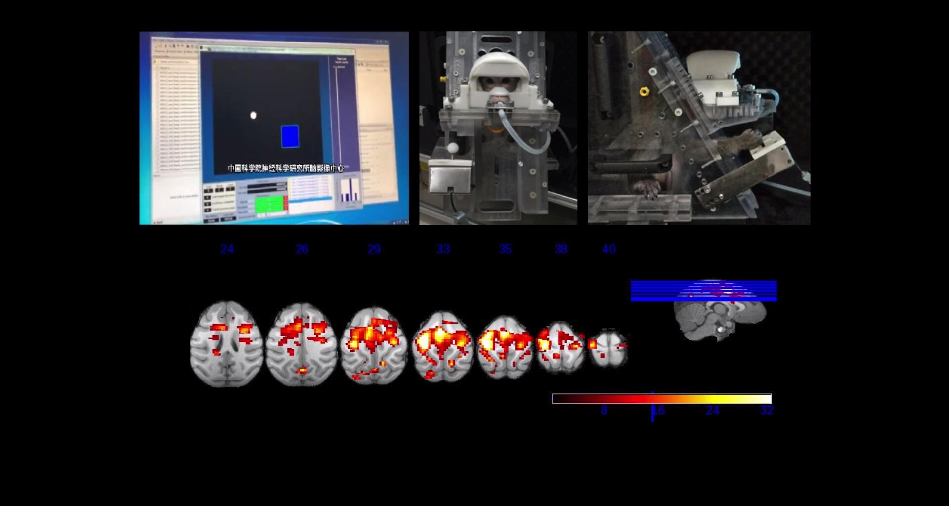 五个能控制你大脑的可怕实验,电击治疗精神分裂症会失忆吗