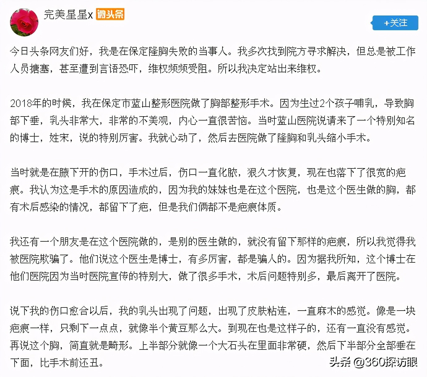 整容过多的风险,整容失败最惨的案例石家庄