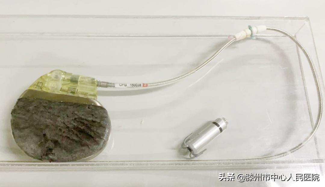 冠心病监护病房成功完成无导线心脏永久起搏器植入术