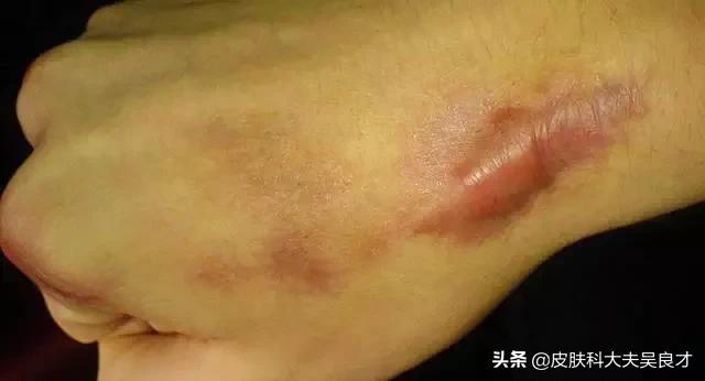 省省吧！这些常见皮肤问题，护肤品根本解决不了