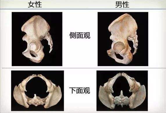 难产女性的骨盆,骨盆窄容易难产吗