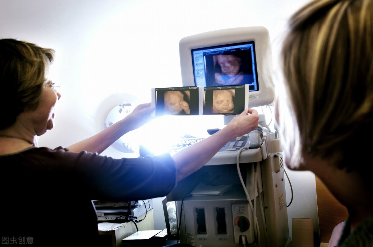 产检日记:NT结果3.0,悲观妈妈在孕13周迎来了重要检查