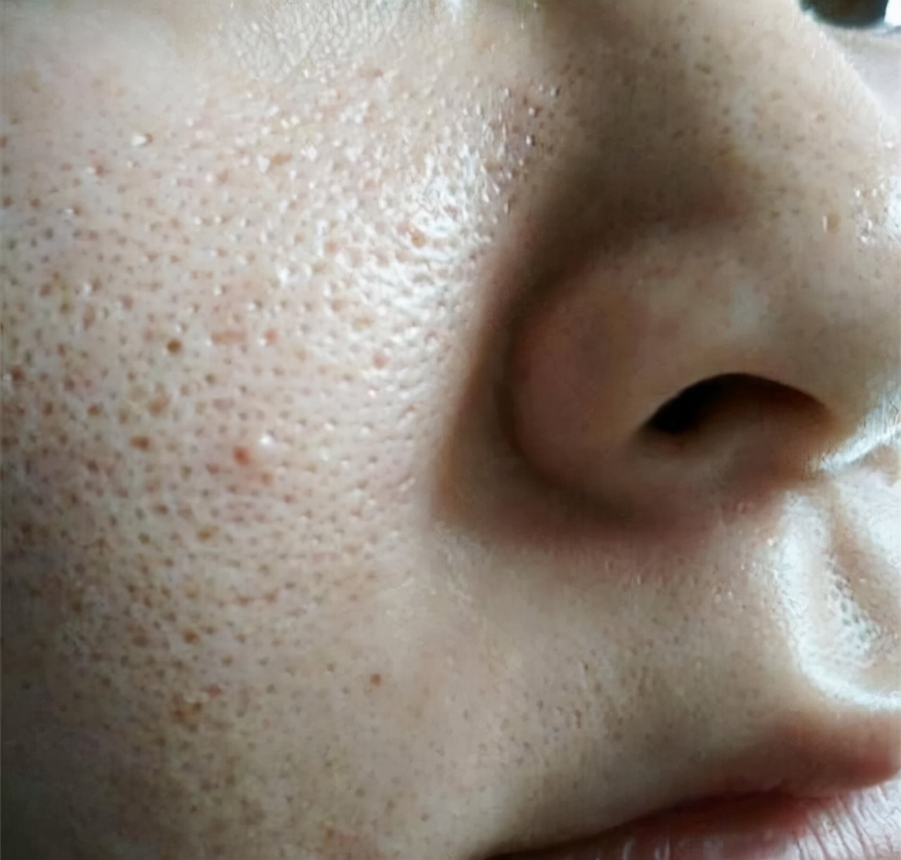 为啥要去脸部角质,为什么要去皮肤上的角质