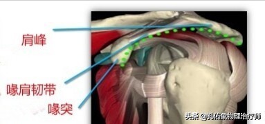 肩周炎肩膀疼是什么原因造成,肩周炎导致的肩膀疼痛怎么缓解