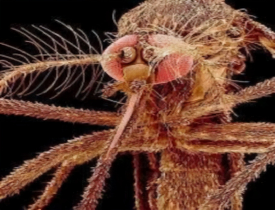 阴虱怎么治疗阴虱最怕什么,阴虱什么情况才会感染