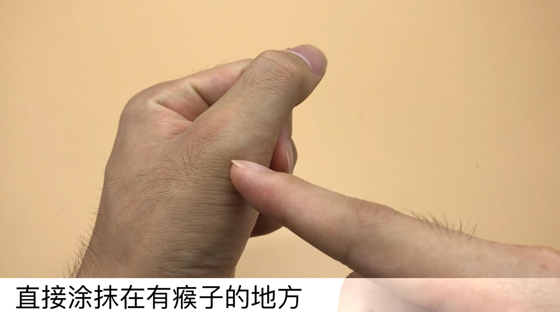 香蕉皮太厉害了，好多人的难题全都解决了，看完赶紧告诉家里人