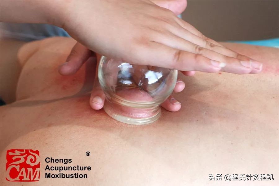 不容小觑的皮肤瘙痒症,冬季皮肤瘙痒用什么药效果最好