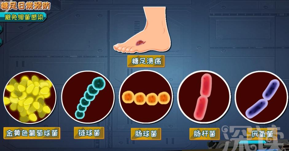 糖尿病足截肢步骤,干性糖足坏疽必须截肢吗