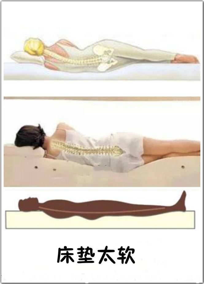 睡硬板床不要睡软床,医生让睡硬床垫真的对吗