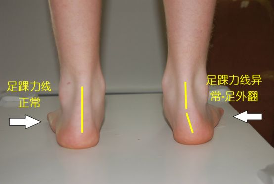 买跑鞋尺码怎么选,买跑鞋怎么买大半码