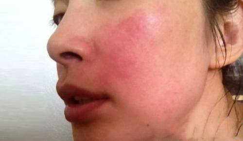 白醋洗脸可以美颜,女生用白醋洗脸