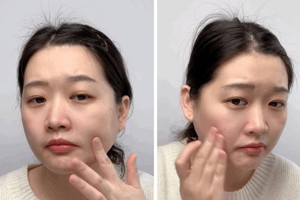 长黑头VS不长黑头差距这么大?精致女孩如何绕过黑头这道坎?