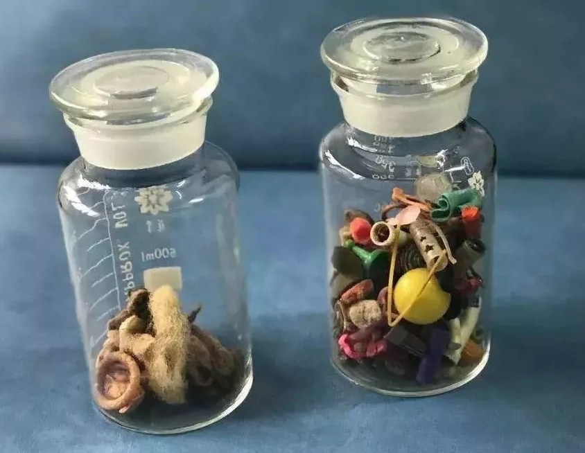 濂崇浣撳唴涓嶆槑鍘熷洜鍑鸿,濂崇浣撳唴鑾悕澶ч噺鍑鸿