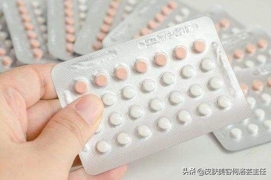 治疗痤疮用的避孕药有哪些,为什么治疗痘痘需要避孕药