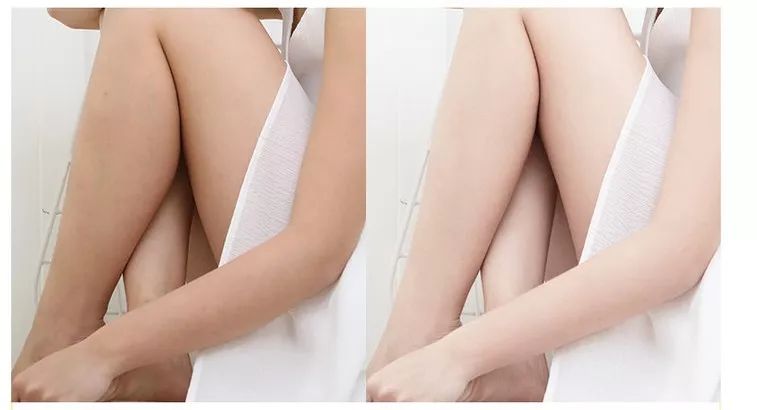 冬天皮肤干燥起皮屑用什么护肤品,一到冬天脸部干燥起皮补什么