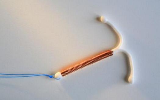 取环备孕需要准备什么,取环备孕注意什么