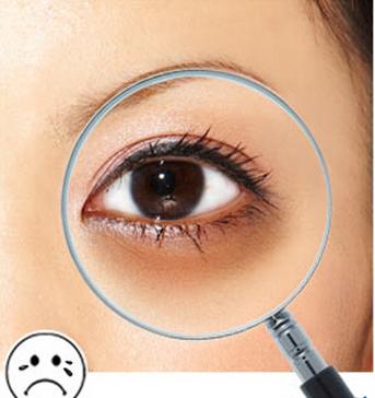 黑眼圈形成的原因有哪些,黑眼圈的形成原因与治疗方法