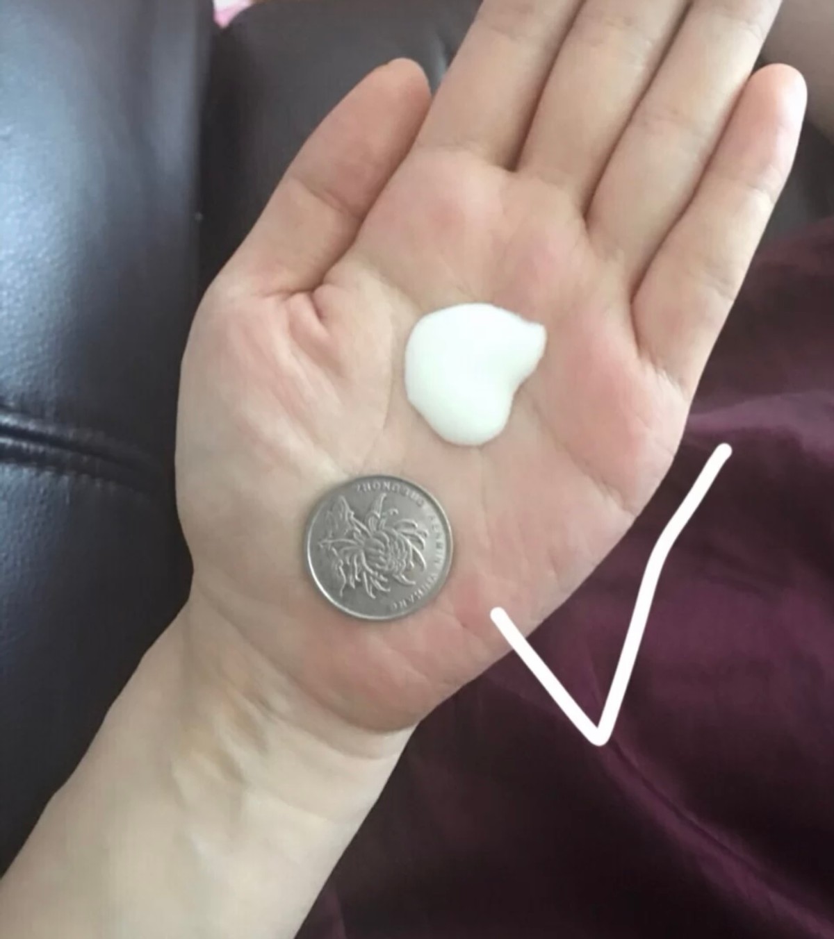 去鸡皮肤亲身经历,鸡皮蜕变