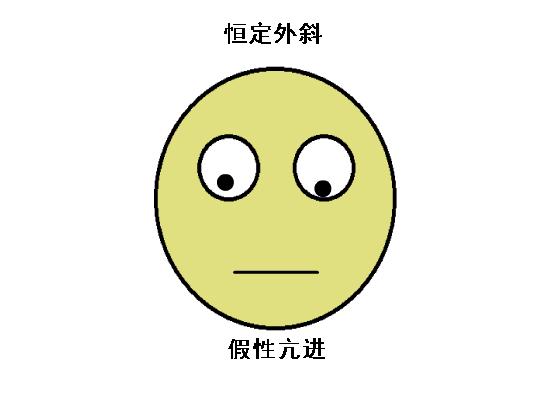 正常眼位和斜视眼位,斜视眼的几大症状