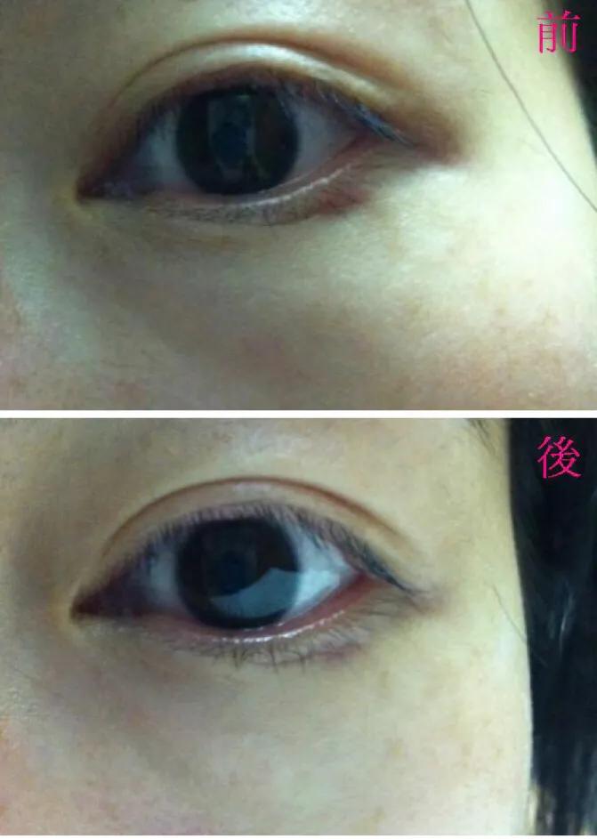 测试国际眼霜哪个牌子好用,质量好的眼霜品牌