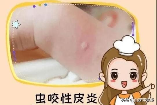 皮肤起风团很痒与血液有关吗,皮肤起红疹会是梅毒吗