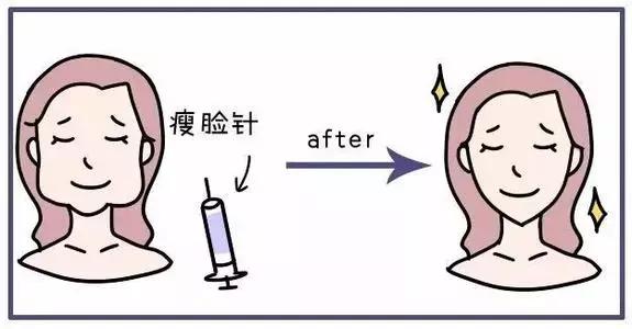 肉毒素瘦脸的保持时间,肉毒素也能瘦脸吗