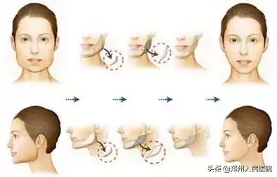 颧骨高腮帮大用什么方法,颧骨外扩下颌角宽瘦下来好看吗