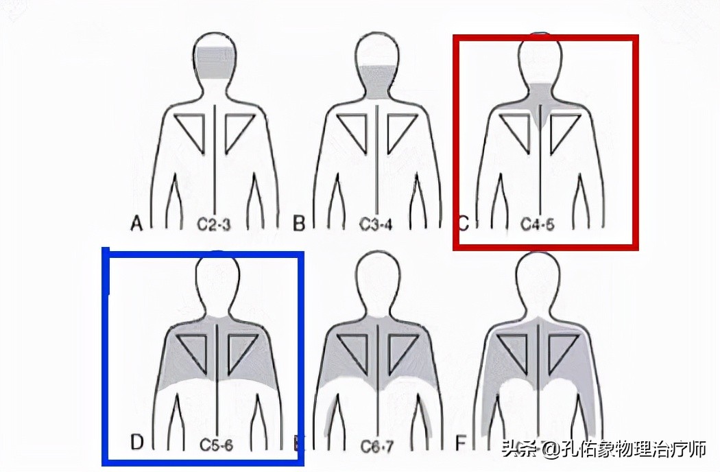 肩膀后部疼痛什么原因,肩胛骨和肩膀关节疼痛什么原因