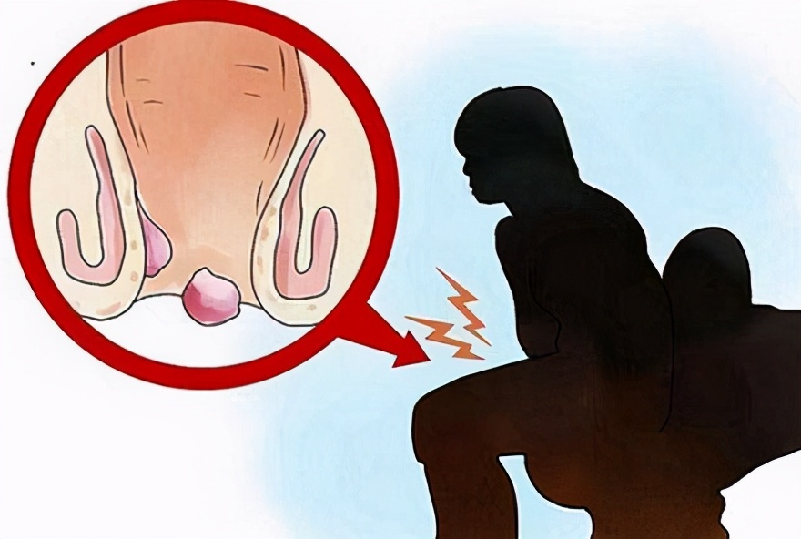 “菊花”残满地伤，48小时解决“羞羞”的问题