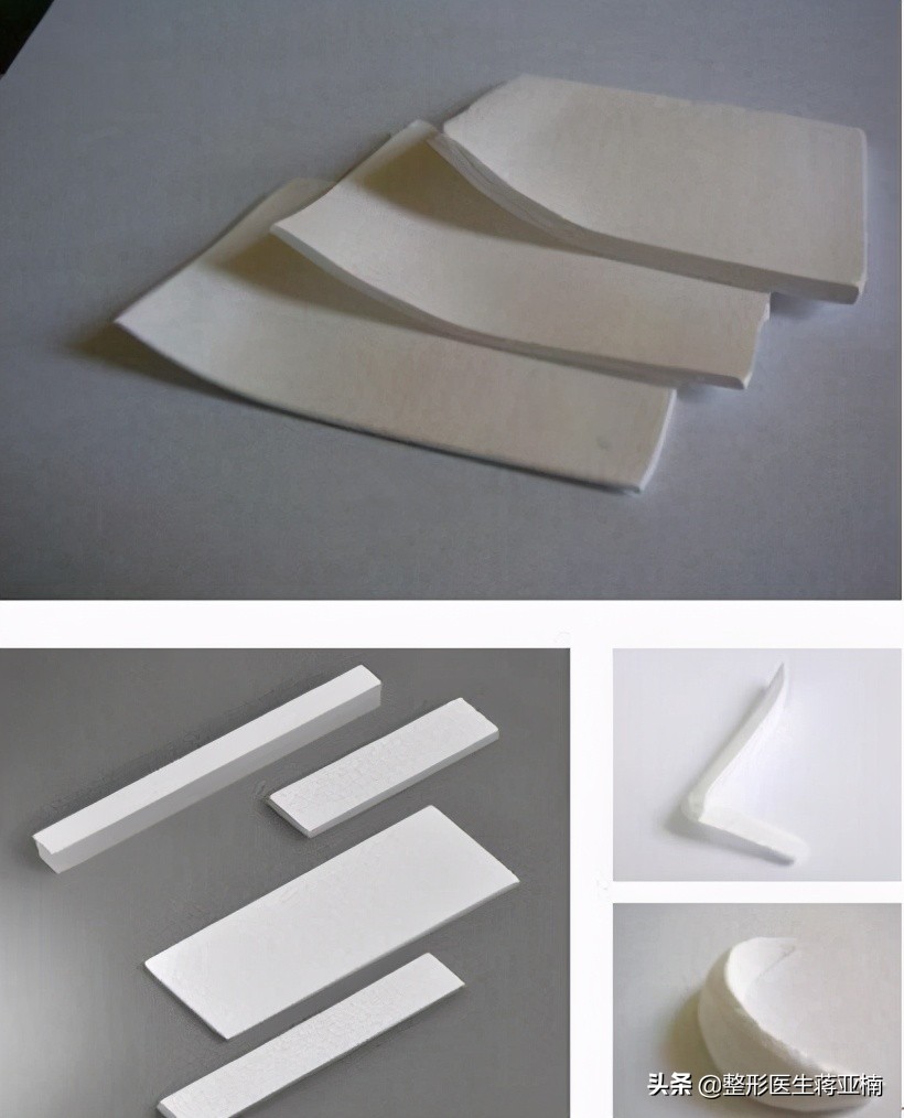 膨体隆鼻感染的症状是什么,膨体隆鼻感染不取出不行吗