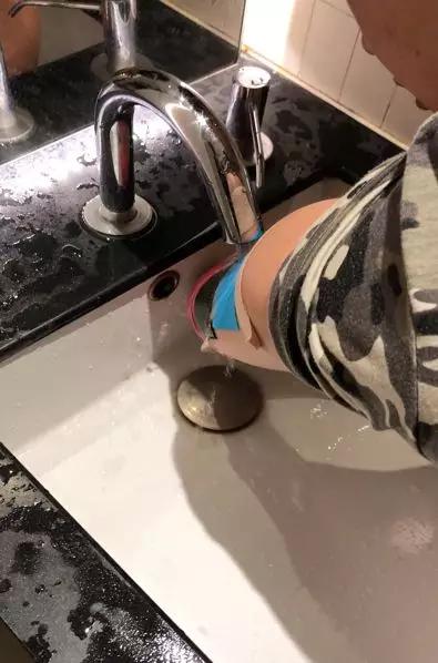 赵辉医生骨科,赵辉医生视频大全