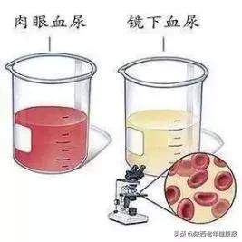 尿液存在身体哪个器官,尿液可以知道身体哪些情况