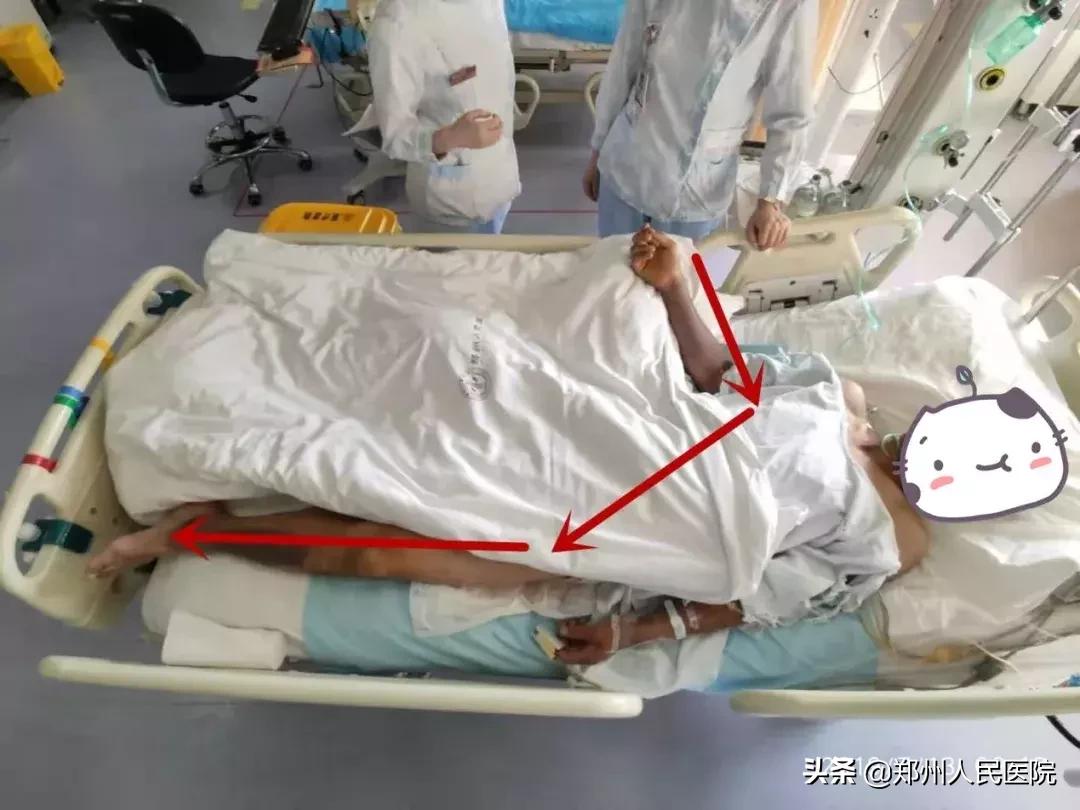 “砰”的一声，我把自己送进了ICU—“一位电击伤患者的自述”