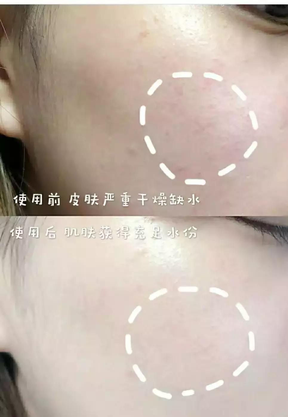 李佳琦推荐的这款日本蜜梨面霜，几分钟卖2万瓶？