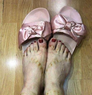 冉莹颖穿10小时高跟鞋，脱鞋后“触目惊心”，女人为了美真是拼了