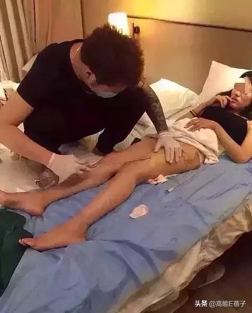 微整形需要多久,微整形后多久恢复正常