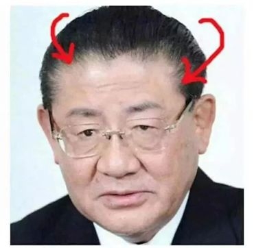 90后没有发际线,90后00后如何不脱发