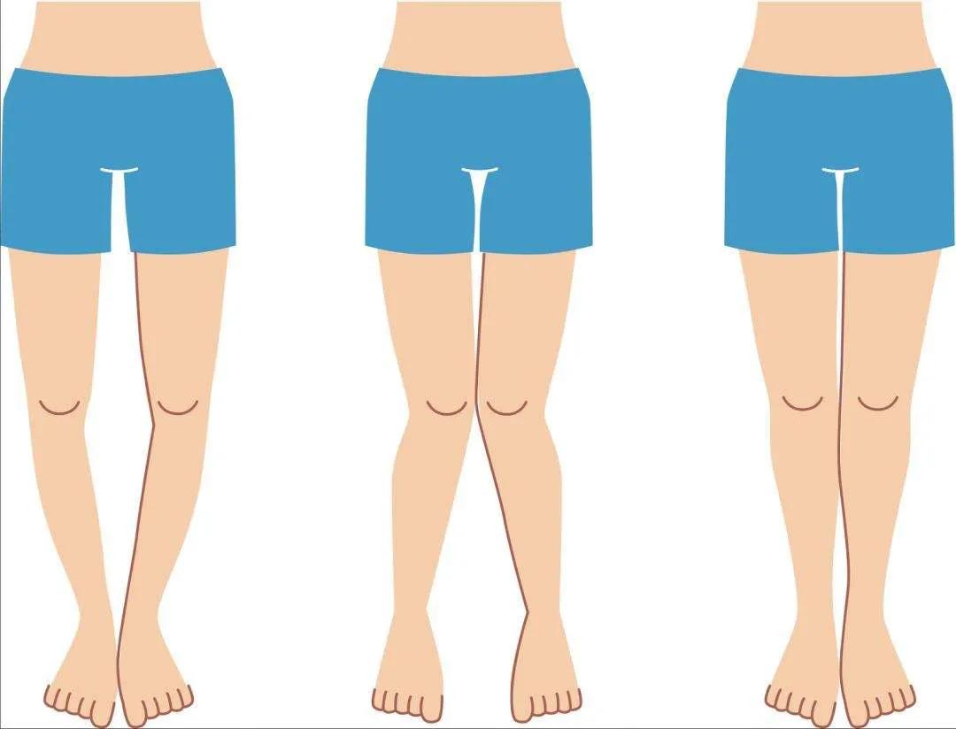 关注“跑偏”的鞋子，提示你的健康问题！