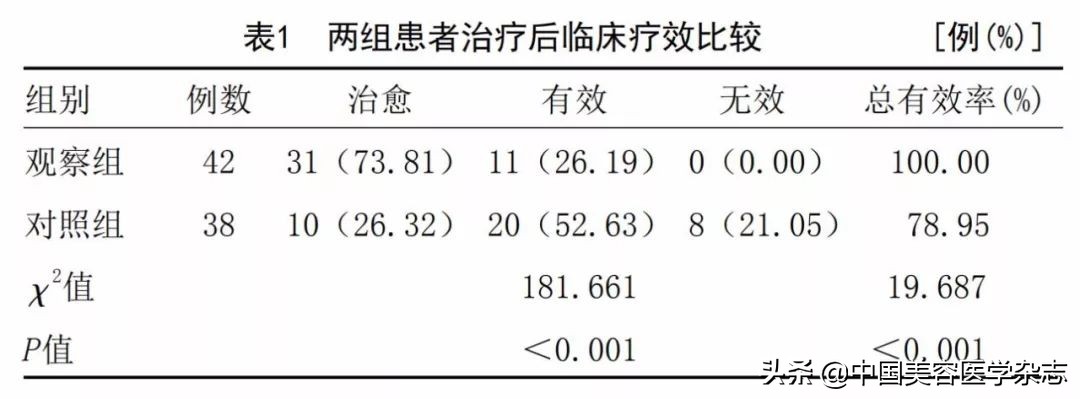 调Q脉冲激光联合甲硝唑凝胶和多西环素治疗轻中度玫瑰*疮痤**疗效研究