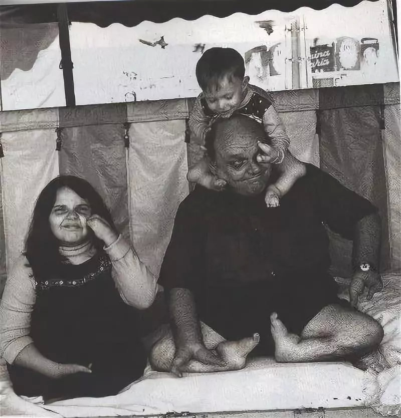 他用罪恶对抗悲惨命运，生理缺陷活被当成杀人利器