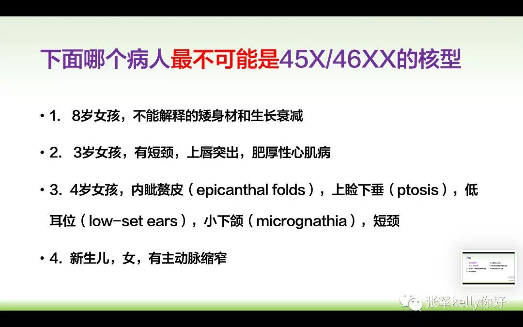 Turner综合征的指南学习