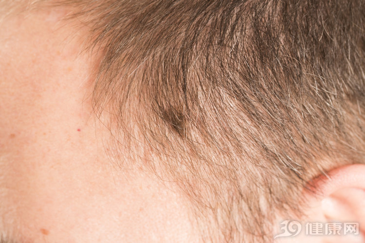 痣和黑色素瘤区别在哪里,痣和黑色素瘤区别在哪