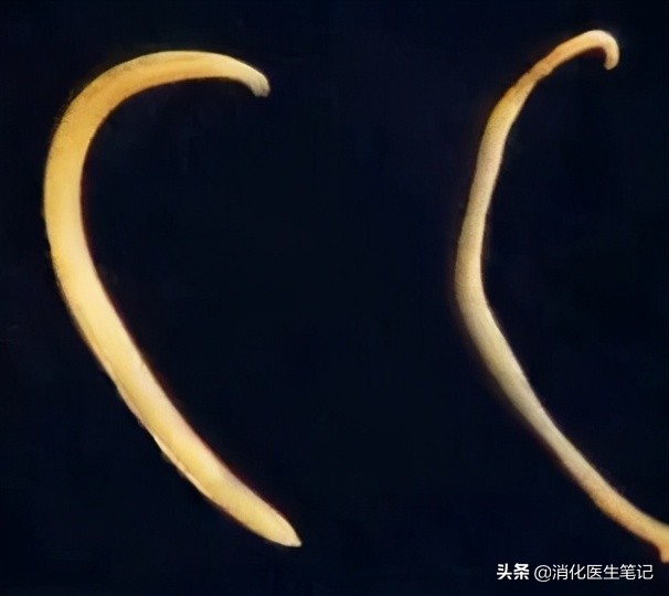 老年人肠胃镜检查,65岁老人胃肠镜检查