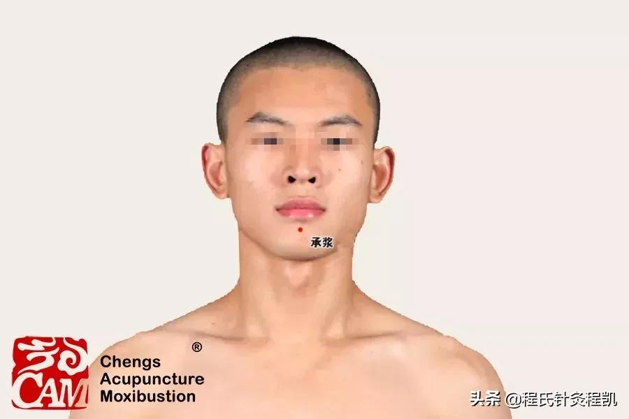 中医调理桥本甲状腺炎,甲状腺桥本最怕的穴位图