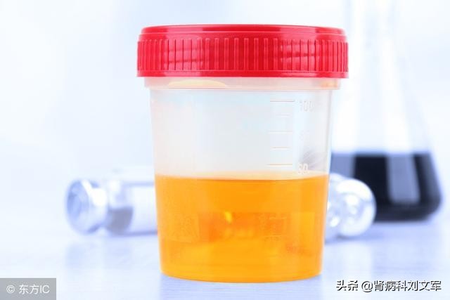 从蛋白尿血尿到尿毒症有多久,长期血尿会贫血吗