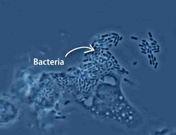 女孩多大接种hpv效果最好,女生多少岁打hpv疫苗合适