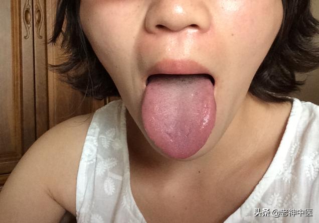 糖尿病患者，体重仅剩30公斤，生命垂危！中医如何救治？